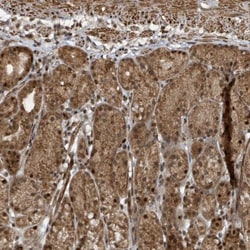 PHIP Antibody, Novus Biologicals 0.1mL; Unlabeled:Antibodies, Polyclonal
